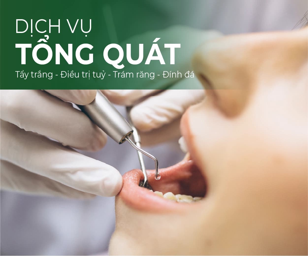 Minh hoạ dịch vụ Nha khoa tổng quát