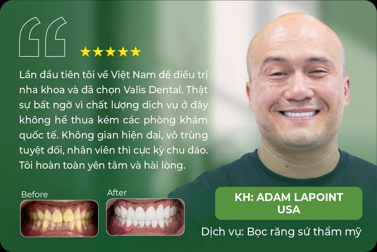 Cảm nhận của khách hàng Adam Lapoint (USA) sau khi bọc răng sứ thẩm mỹ tại Valis Luxury: “Lần đầu tiên tôi về Việt Nam để điều trị nha khoa và đã chọn Valis Dental. Thật sự bất ngờ vì chất lượng dịch vụ ở đây không hề thua kém các phòng khám quốc tế. Không gian hiện đại, vô trùng tuyệt đối, nhân viên thì cực kỳ chu đáo. Tôi hoàn toàn yên tâm và hài lòng.”